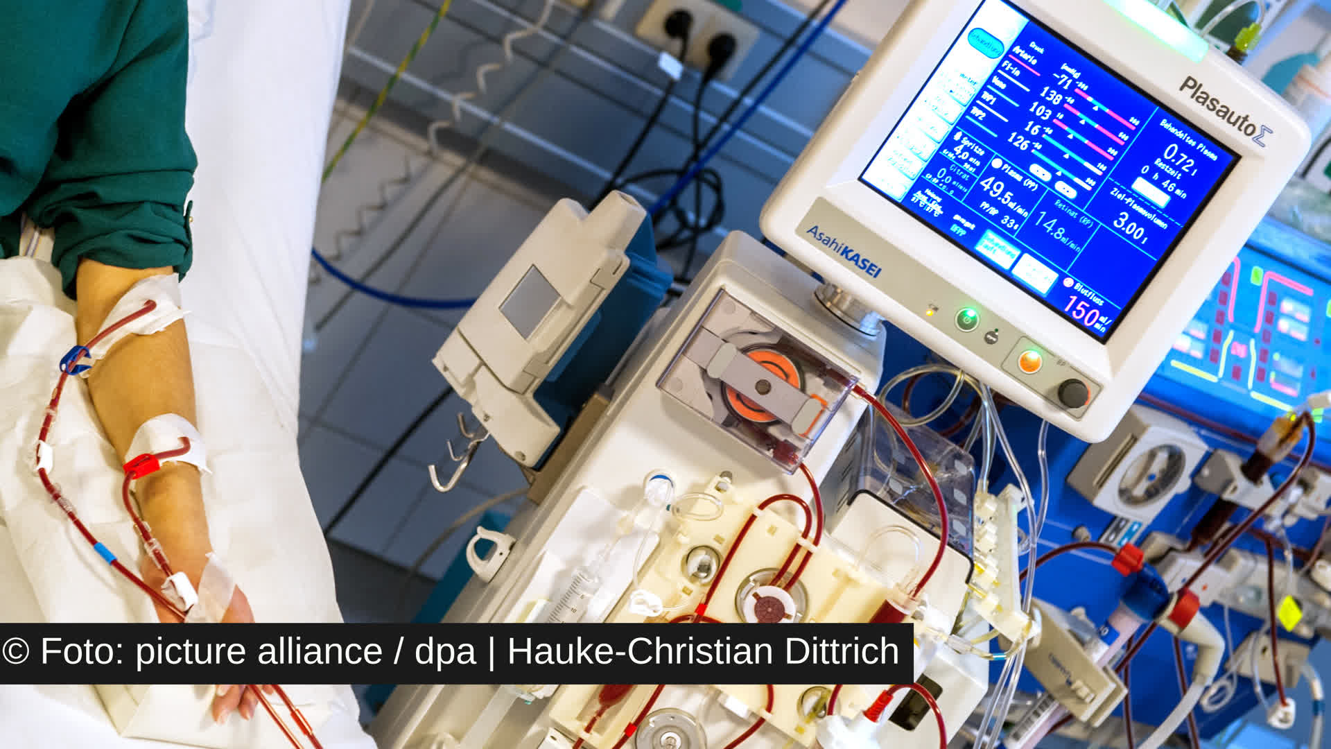 Experten sehen im Gesetz über Lebendorganspenden eine wichtige Initiative